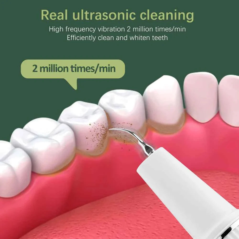 Visual Dental Scaler For Teeth Tartar Remover Electric Teeth Cleaner Tooth Calculus Plaque Remover Ultrasonic Stone Removal