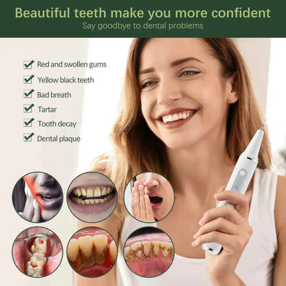 Visual Dental Scaler For Teeth Tartar Remover Electric Teeth Cleaner Tooth Calculus Plaque Remover Ultrasonic Stone Removal