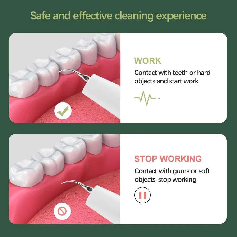 Visual Dental Scaler For Teeth Tartar Remover Electric Teeth Cleaner Tooth Calculus Plaque Remover Ultrasonic Stone Removal