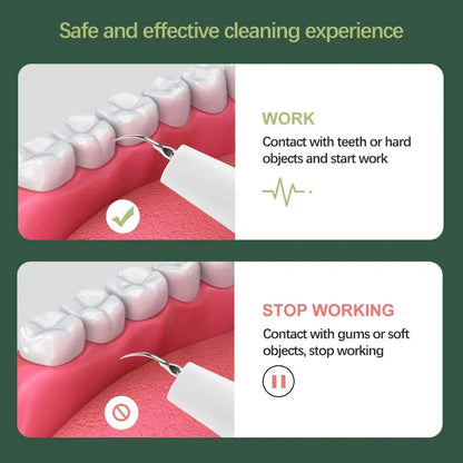 Visual Dental Scaler For Teeth Tartar Remover Electric Teeth Cleaner Tooth Calculus Plaque Remover Ultrasonic Stone Removal