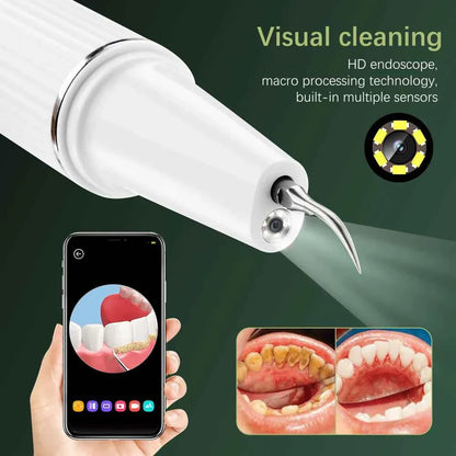 Visual Dental Scaler For Teeth Tartar Remover Electric Teeth Cleaner Tooth Calculus Plaque Remover Ultrasonic Stone Removal