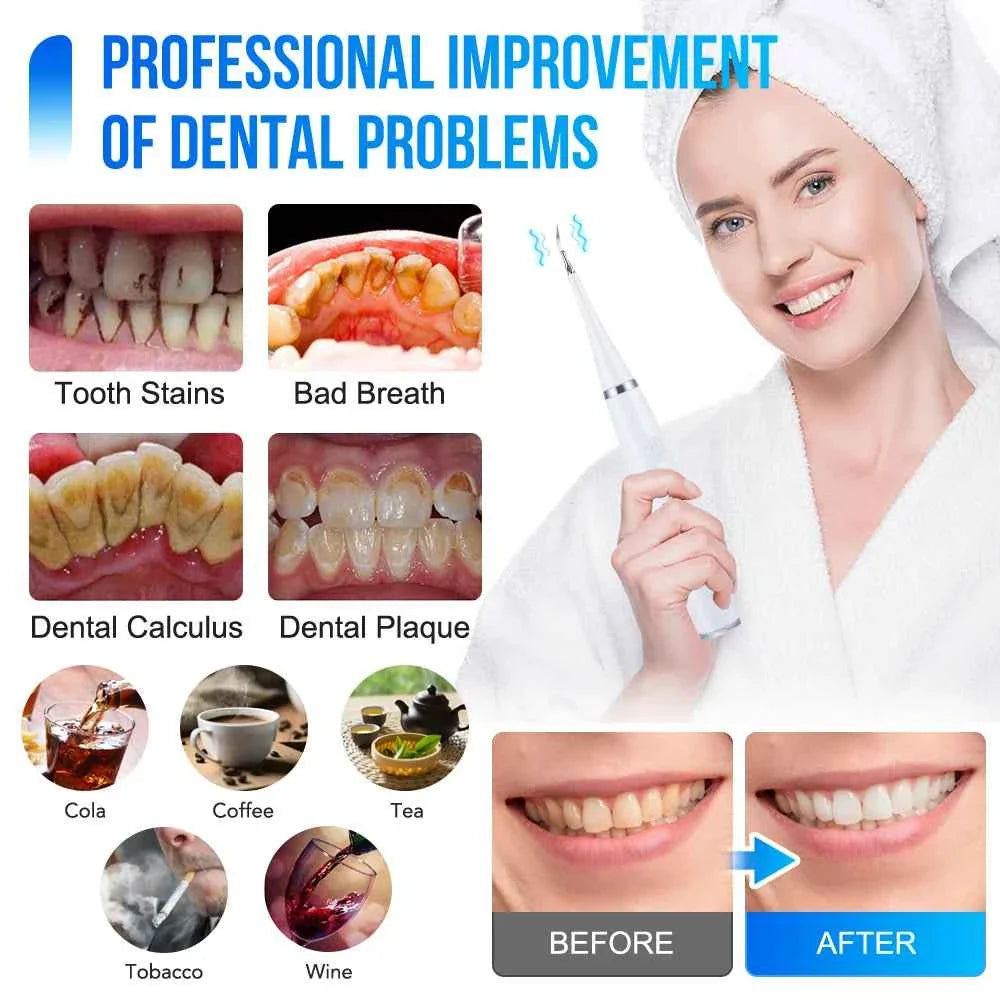 Electric Sonic Dental Scaler for Teeth Tartar Plaque Stains Cleaner Tooth Calculus Tooth Stone Remover Teeth Whitening Oral Care