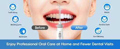 Home Water Flosser, 600 ml Large Capacity,10 Adjustable Pressures,6 Home Nozzles Professional Oral Irrigator for Teeth Clean