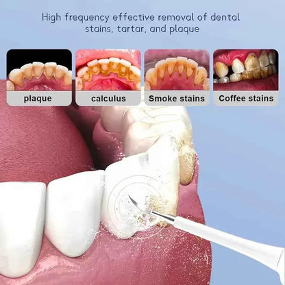 Sonic Electric Teeth Cleaner Dental Calculus Remover Whitening Waterproof Tartar Oral Care Sonic Toothbrush