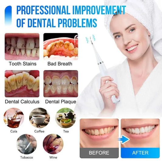 Electric Sonic Dental Scaler for Teeth Tartar Plaque Stains Cleaner Tooth Calculus Tooth Stone Remover Teeth Whitening Oral Care