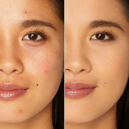 Moisturizing Liquid Foundation Covering Black Circles Blemishes Acne Marks Spots Oil-control Concealer Cream Waterproof Makeup